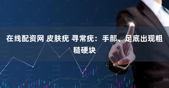 在线配资网 皮肤疣 寻常疣：手部、足底出现粗糙硬块